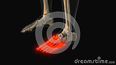 Medical animation of the metatarsal and phalanges bone pain Stock Photo