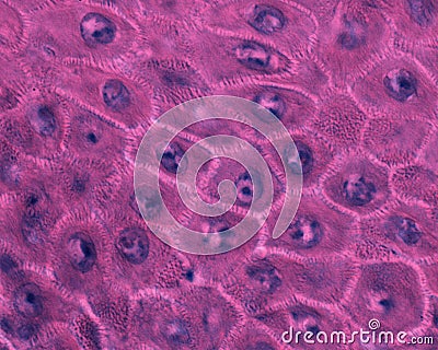 Epidermis. Stratum spinosum. Desmosomes Stock Photo