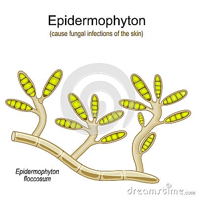 Epidermophyton floccosum. fungal infections Vector Illustration