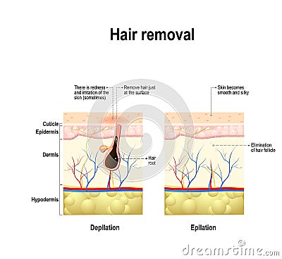 Epilation and depilation difference Vector Illustration