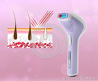 Epilation procedure. Modern appliance and illustration of hair follicles on background Cartoon Illustration