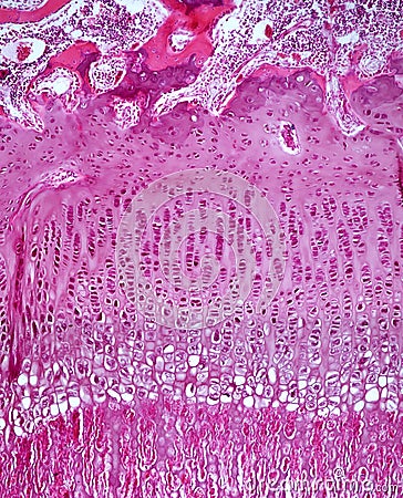 Epiphyseal plate Stock Photo