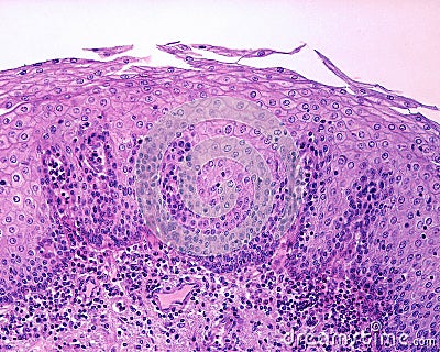 Epithelium of esophagus Stock Photo