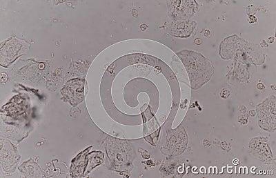 Epithelial tissue with bacteria cells yeast cells Stock Photo