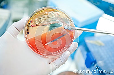 Escherichia coli bacteria Stock Photo