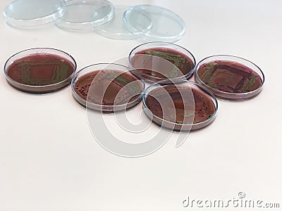 Escherichia coli E.coli cultured with Eosin Methylene Blue EMB Agar in Petri dish show the metallic green sheen colonies using Stock Photo