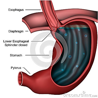 Esophageal sphincter anatomy 3d medical illustration on white background Cartoon Illustration