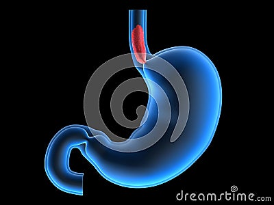 Esophagus Cartoon Illustration