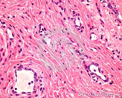 Esophagus submucosa. Connective tissue Stock Photo