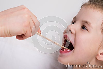 examination of the throat of a little girl, a little girl opened her mouth wide Stock Photo