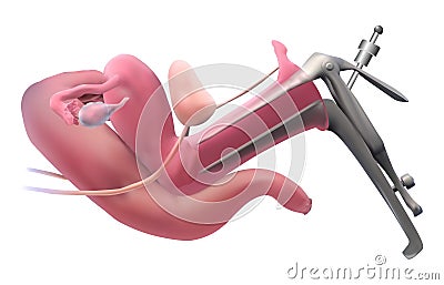Examining the uterus Stock Photo
