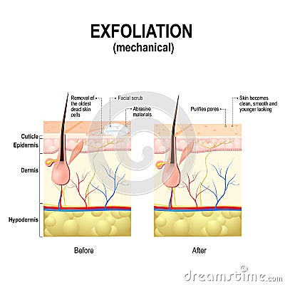 Exfoliation or peel is cosmetic procedures Vector Illustration