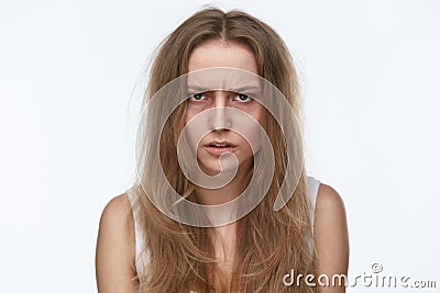 Exhausted Young Woman With Bruises Under Eyes Stock Photo