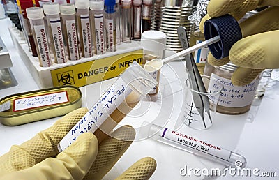 Experienced laboratory scientist analyzing a fecal sample, botulism infection in sick people Stock Photo