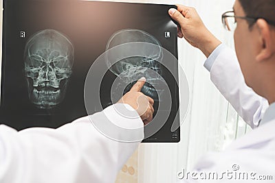 Expertise doctor planning treatment for medical concept. Two asian doctor looking at film x-ray head of patient and discussing Stock Photo