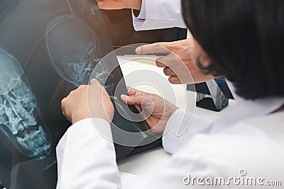 Expertise doctor planning treatment for medical concept. Two asian doctor looking at film x-ray head of patient. Stock Photo