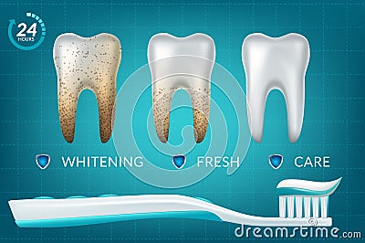Extra Whitening Toothpaste Healthy Teeth Concept. Vector Realistic Set Illustration 3d Extruded Toothpaste, Brandname Vector Illustration