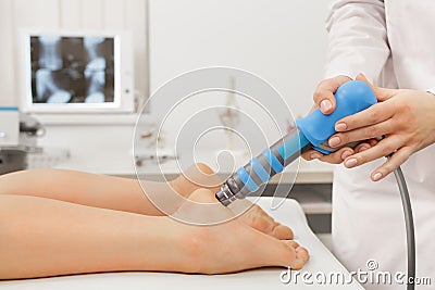 Extracorporeal Shockwave Therapy ESWT.Effective non-surgical treatment.Physical therapy for plantarfascitis with shock Stock Photo