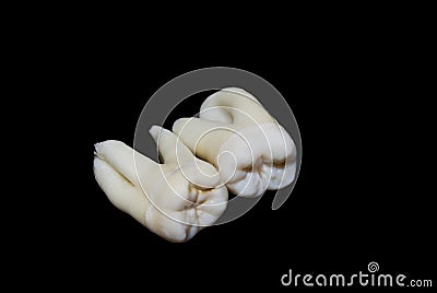 Extracted human teeth Stock Photo