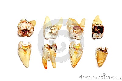 Extracted teeth on a white background Stock Photo