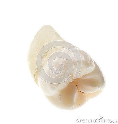 Extracted wisdom tooth isoalted on white Stock Photo