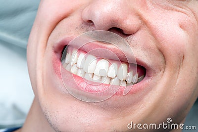 Extreme close up of human male mouth showing teeth. Stock Photo