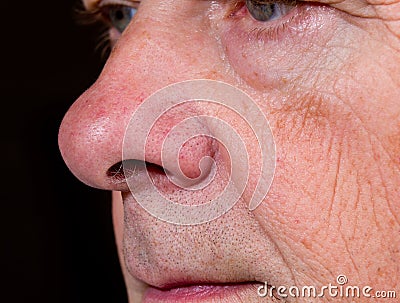 Extreme close up of senior nose in side view Stock Photo