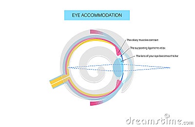 Eye accommodation poster Vector Illustration