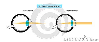Eye accommodation poster Vector Illustration