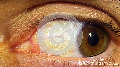 pulsating eyeballs pulsating eyeballs
