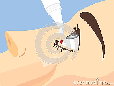 Eye treatment with eye drops Vector Illustration