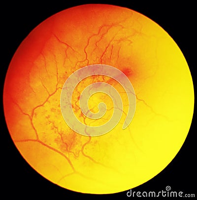 Eye under microscope Stock Photo