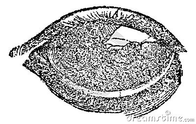 Eye with Vesicular or Pustular Keratitis, vintage engraving Vector Illustration
