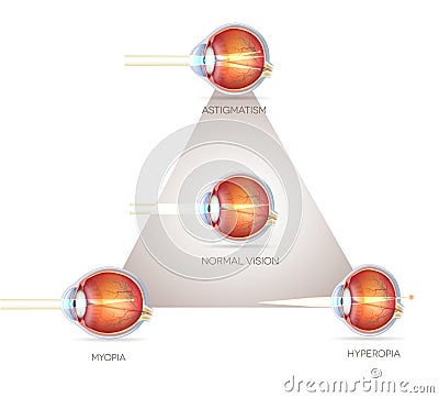Eye vision triangle Vector Illustration