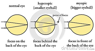 Eyesight Stock Photo