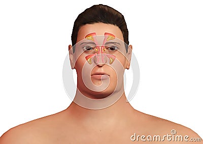 Face of man with nasal sinuses inflamed with sinusitis. Allergic sinusitis and body malaise Stock Photo