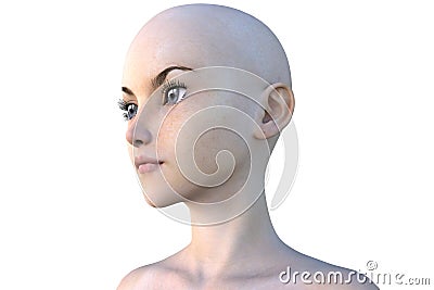 Face of one young bald girl. White skin Stock Photo