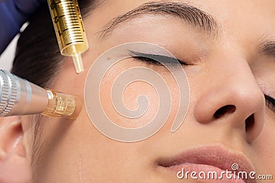 Face shot of woman at micro needle cosmetic treatment session Stock Photo