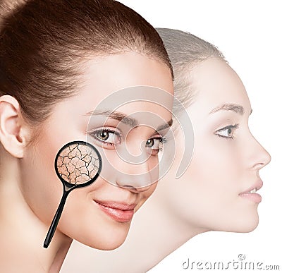 Face of young woman with dry skin. Stock Photo