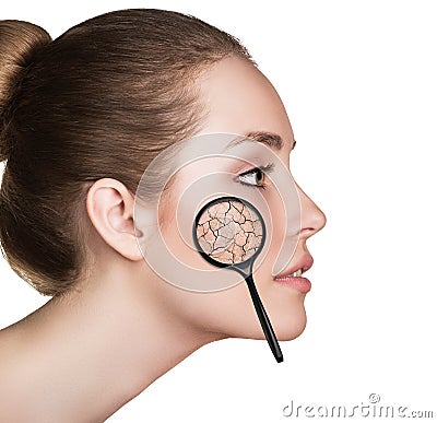 Face of young woman with dry skin. Stock Photo