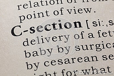 Definition of C-section Stock Photo