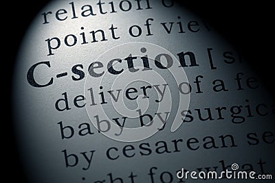 Definition of C-section Stock Photo