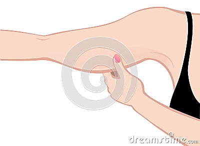 Fat arm Vector Illustration