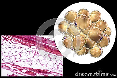 Fat cells, micrograph and 3D illustration Cartoon Illustration