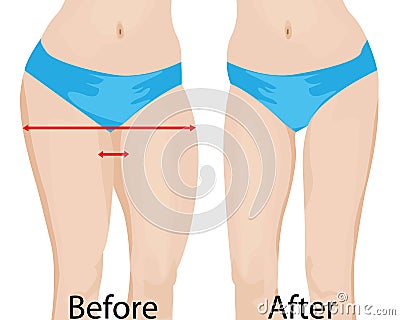 Fat and slim girls` hips. Before and after. Vector Illustration