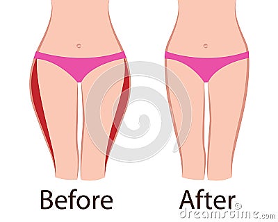 Fat and slim girls` hips. Before and after. Vector Illustration