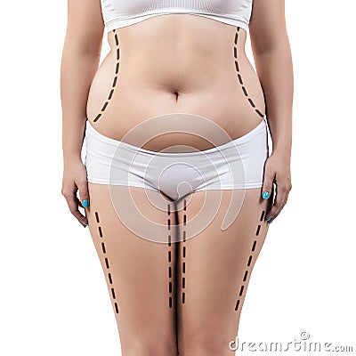 Fat woman with dotted lines on her body. Stock Photo