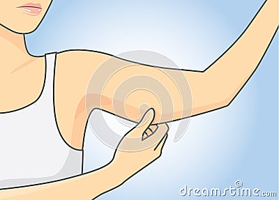 Fatty in arm Vector Illustration