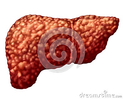 Fatty Liver Disease Cartoon Illustration