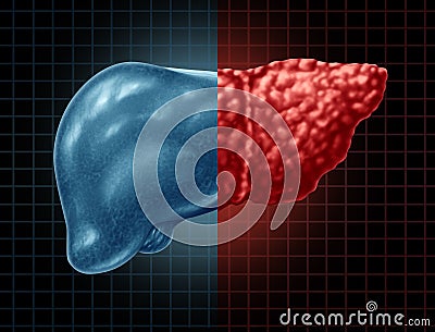 Fatty Liver Disease Cartoon Illustration